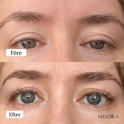 Biopeptid øjenvippevækstserum