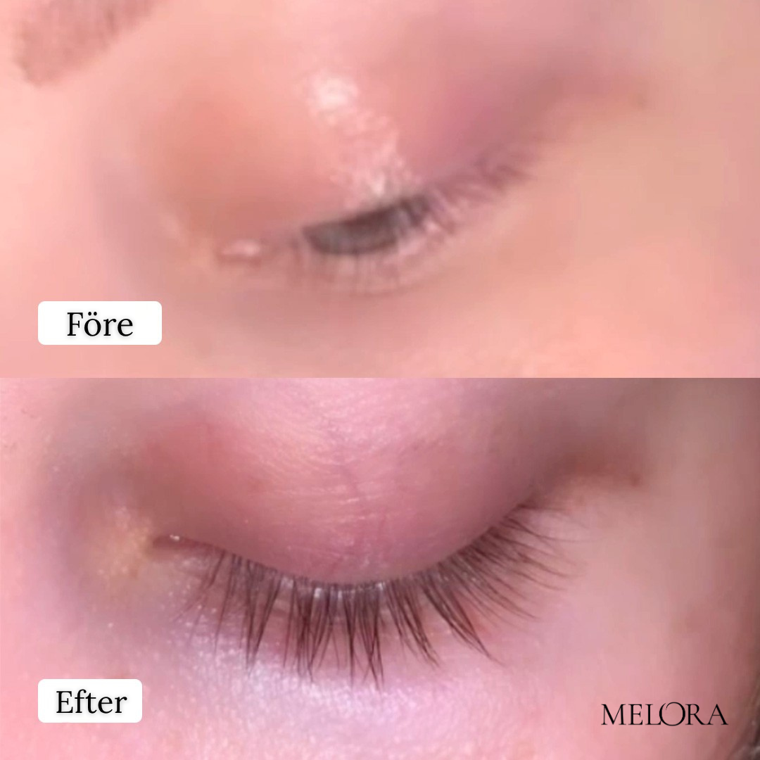 Biopeptid øjenvippevækstserum