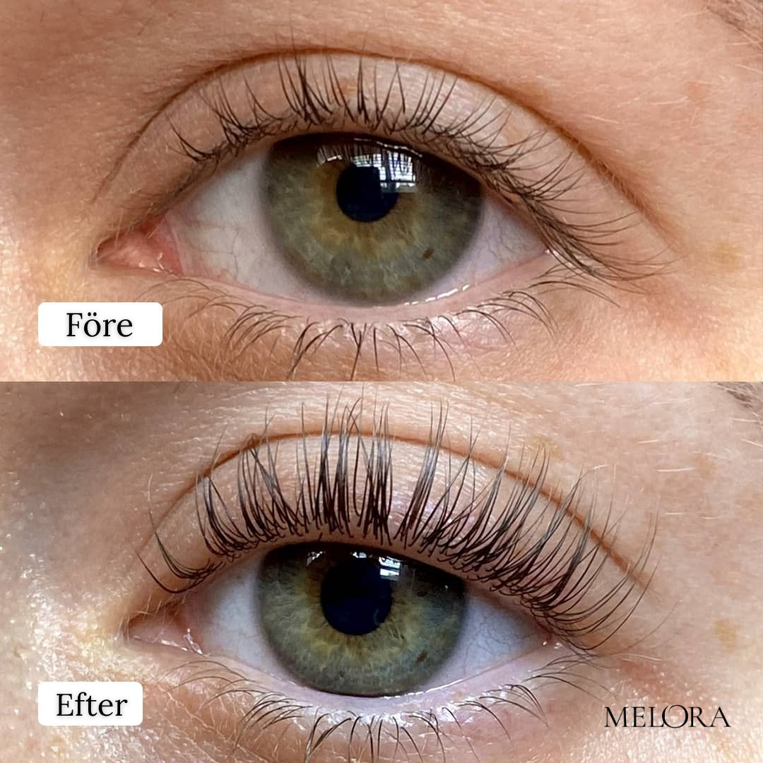 Biopeptid øjenvippevækstserum